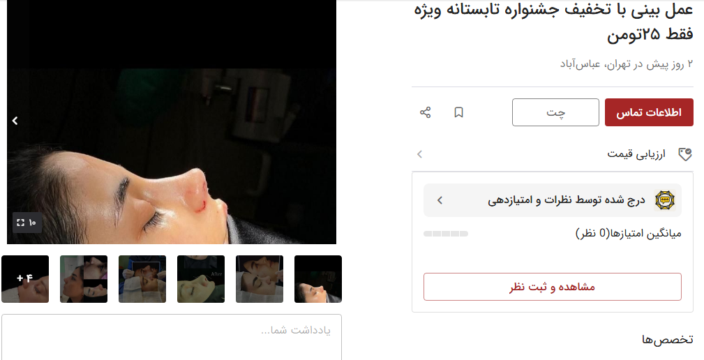 قیمت عمل بینی