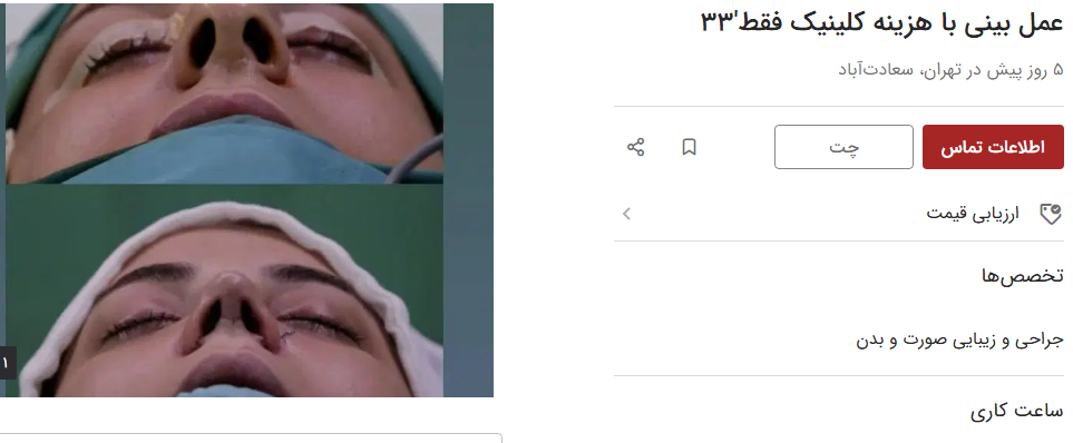 قیمت جراحی زیبایی بینی