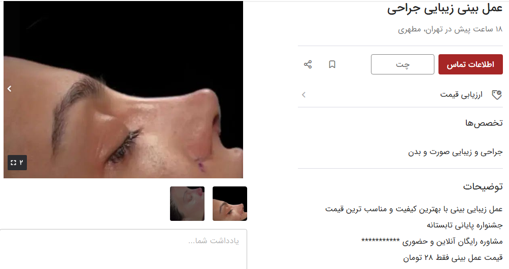 قیمت جراحی بینی