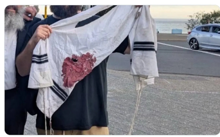 واکنش‌های بین المللی به حادثه استرالیا، از استارمر تا رییس کمیسیون اروپا