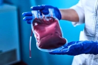 خون پیر مغز را آلزایمری می‌کند!