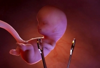 انهدام شبکه سازمان‌یافته سقط غیرقانونی جنین در سمنان/ متهمان روانه زندان شدند