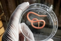 این 12 علامت یعنی انگل‌ها در بدن‌تان جا خوش کرده‌اند!