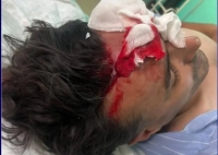 حادثه تلخ در ورزشگاه یاسوج: جمجمه شکست!